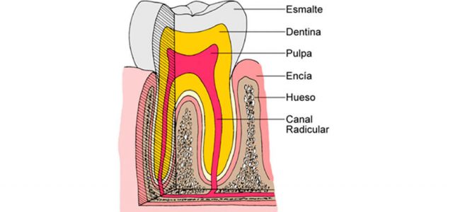 ¿Cómo eliminar el dolor dental? ¿Qué es una endodoncia? 